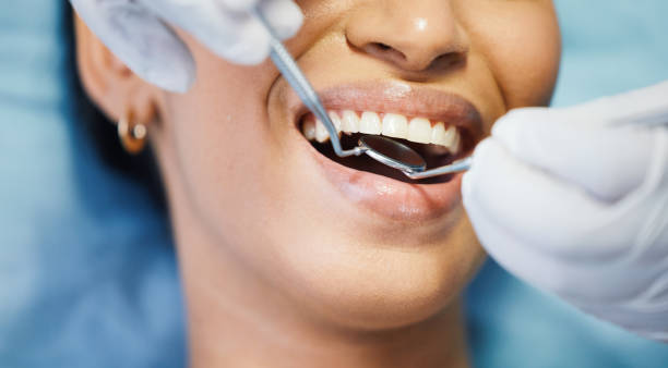Best Emergency Wisdom Tooth Extraction in Buttonwillow, CA