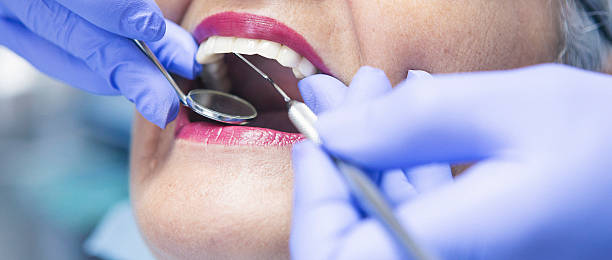 Best Emergency Treatment for Oral Infections in Buttonwillow, CA